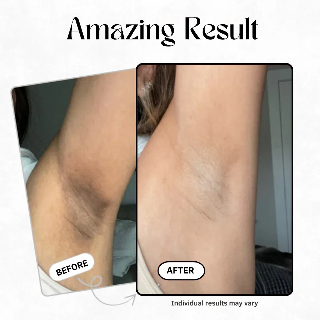 LumaCare Exfoliating Spray