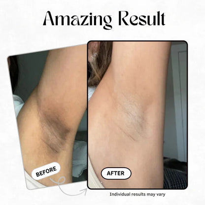 LumaCare Exfoliating Spray